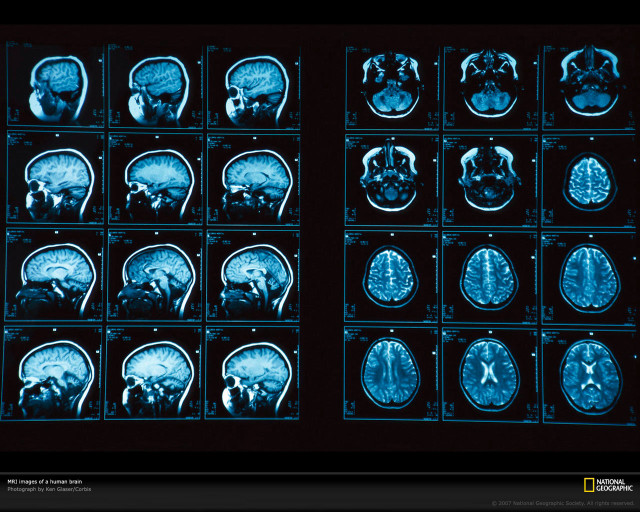 Mri images blue light black free wallpaper for desktop - medium preview image