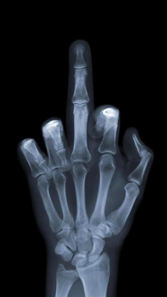 Hand xray thumb area details free wallpaper for mobile - medium preview image