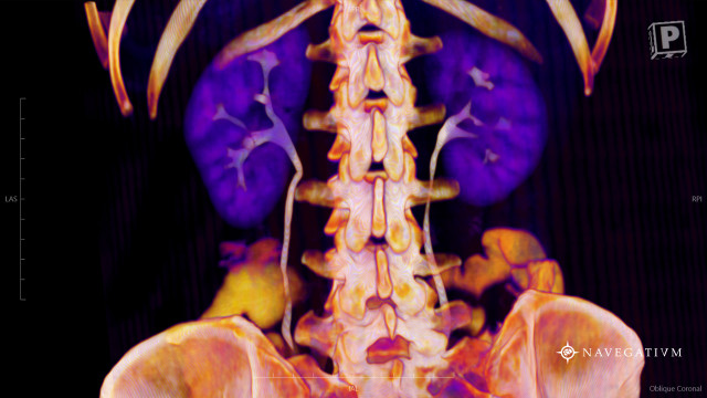 Skeleton purple yellow orange black free wallpaper for desktop - medium preview image