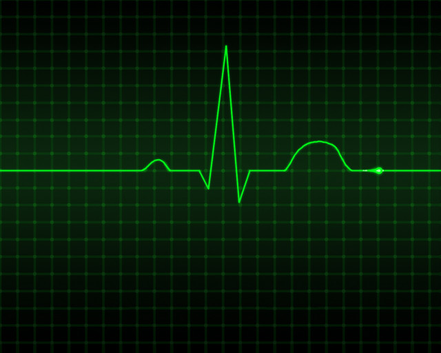 Green heartbeat cardiogram black background free wallpaper for desktop - medium preview image