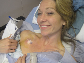 Woman hospital bed bruised arm - upper body free wallpaper for desktop