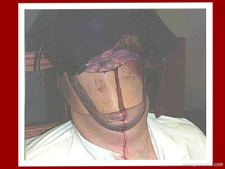 Bandaged man hat blood stained - a blood free wallpaper