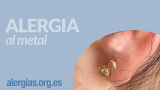 Person earpiercings alergia metal pastel - a picture of a person free wallpaper